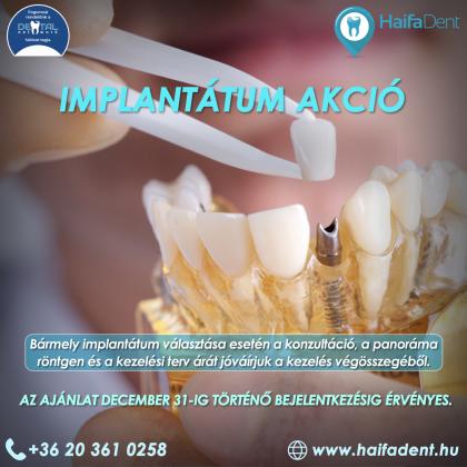 Implantátum Akció