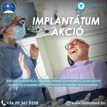 Implantátum Akció
