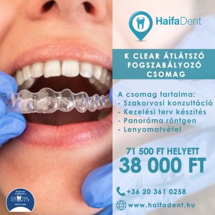 K Clear átlátszó fogszabályozó csomag K Clear átlátszó fogszabályozó csomag