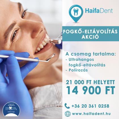 Fogkő Eltávolítás Akció Fogkő Eltávolítás Akció