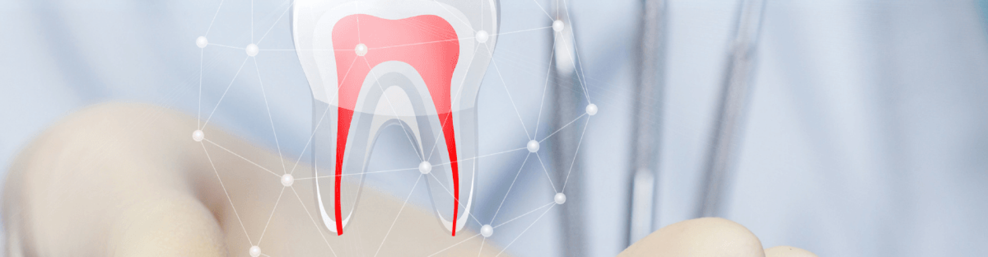 Gyökértömés kisokos