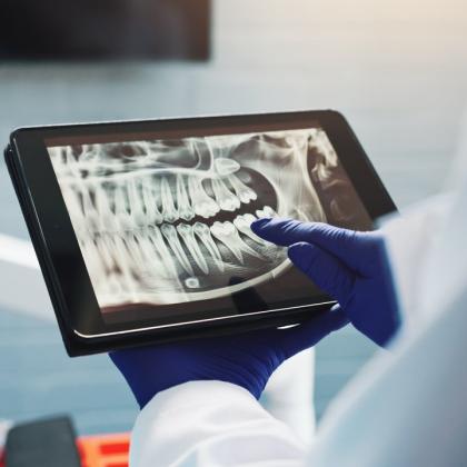 Bölcsességfog fájdalom – mitől alakul ki, és mikor kell fogorvoshoz fordulni? Bölcsességfog fájdalom – mitől alakul ki, és mikor kell fogorvoshoz fordulni?